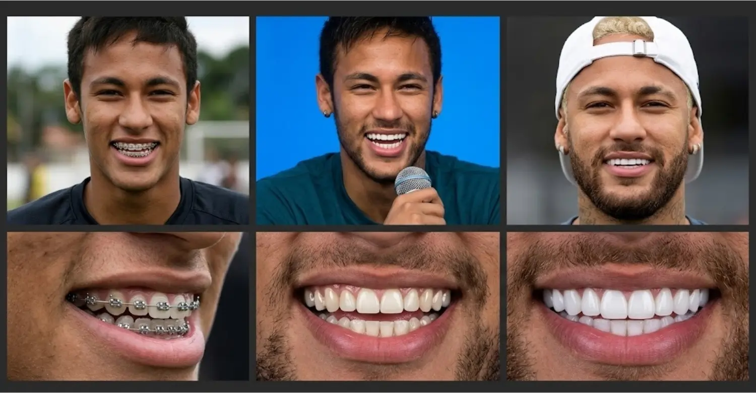 Neymar Smile